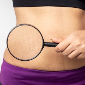 PROTOCOLOS ESPECÍFICOS